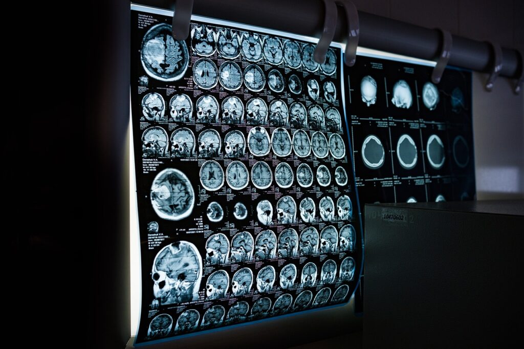 x-ray-6841384_1280
